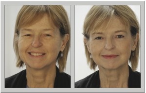 B&A_2 (dragged) 31
