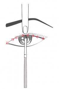 lash filler Face with a Heart